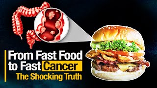 Ultra Processed Foods Cancer Risk: Early Onset Causes & Prevention Diet