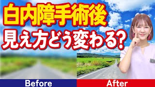 白内障手術後の見え方は？ すぐに見えるの？ 手術後は運転禁止？