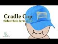 What is cradle cap?  What can I do for cradle cap?