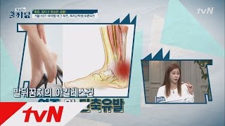 COOLKKADANG 족저근막염을 예방하는 생활습관은? 151129 EP.149