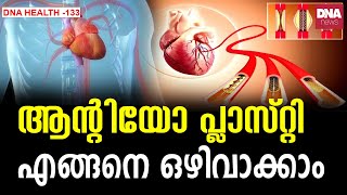 എന്താണ് ആൻജിയോപ്ലാസ്റ്റി ? നിങ്ങൾ അറിഞ്ഞിരിക്കേണ്ട കാര്യങ്ങൾ | dnanewsmalayalam