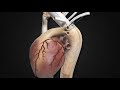 Thoraflex Hybrid Deployment Animation   Terumo Aortic