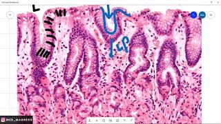 Stomach Histology Slide | Understanding Stomach Mucosa |Med Madness