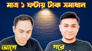 মাত্র ১ ঘন্টায় টাক মাথায় চুল লাগানো হয় | Celebrity and star hair | Hair solution in Malaysia |