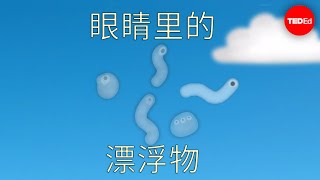 眼睛里为何有漂浮物？ - Michael Mauser