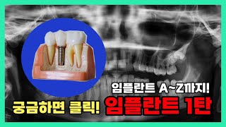 [Dr.이지] 이가 빠졌다고요? 임플란트를 고민 중에 있다고요? | 🦷 치과의사가 알려주는 임플란트에 관한 모든 것_임플란트 1탄 🦷 #13