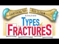 Bone Fracture: Types & Mechanisms | ANIMATION | Fracture classification | The Young Orthopod NEET PG