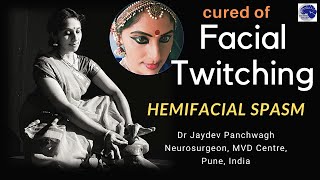 FACE TWITCHING NEAR EYE. HEMIFACIAL SPASM. Dr Jaydev Panchwagh.