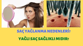 SAÇ YAĞLANMASI NEDENLERİ? 🤔SAÇ YAĞLANMASINA KESİN ÇÖZÜM?👍 #moremo #saçbakımı  #saçyağlanması