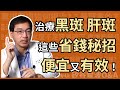 治療黑斑、肝斑，有哪些省錢又有效，高CP值的方法？醫美里長林政賢醫師大揭密！