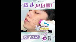 【📻電台主持阿檸推介✨撃退天生包包面🤩「第4代Thermage FLX療程」】