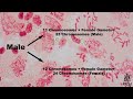 dissection of male locust testis phases of meiosis and mitosis