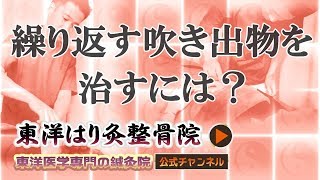 繰り返す吹き出物を治すには？「東洋医学専門 町田の鍼灸院」