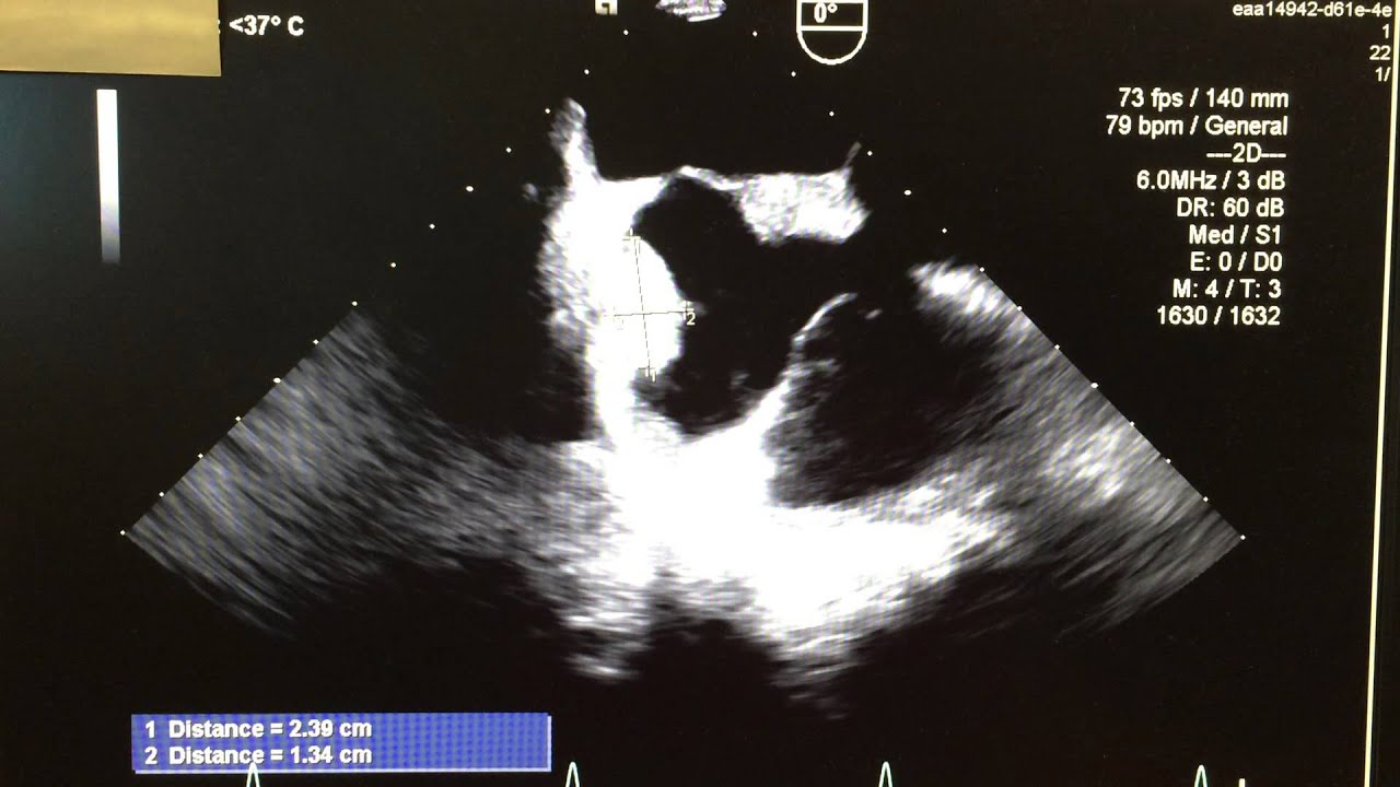 Echo Case 4 Part 2 Youtube