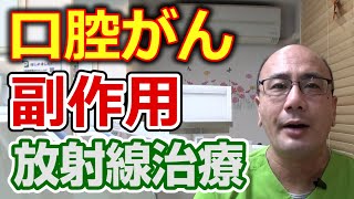 口腔がんの放射線療法による副作用とは？【千葉市中央区の歯医者】