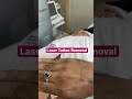 Laser Tattoo Removal | Parisa Skin Clinic| Dr Ashima Goel | Dermatologist #shorts