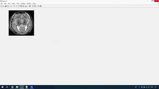 Medical Image Forgery in Matlab