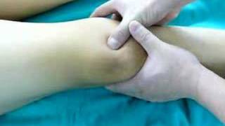 patella dislocation preoperative exam ตรวจร่างกาย ลูกสะบ้าหลุด ปวดเข่า