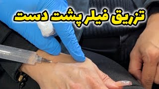 تزریق و جوانسازی پشت دست