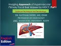 Imaging Approach of Hypervascular primary Focal Liver lesions by MDCT: Part I_English Edition.