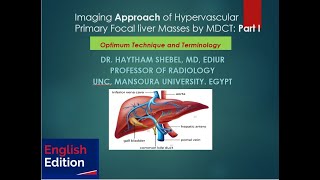 Imaging Approach of Hypervascular primary Focal Liver lesions by MDCT: Part I_English Edition.