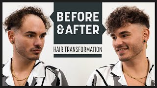 Getting Rid Of Receding Hairline And Thin Spots | With Front System + Scatter Hair