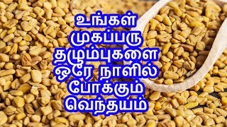 உங்கள் முகப்பரு தழும்புகளை ஒரே நாளில் போக்கும் வெந்தயம்  | Tamil