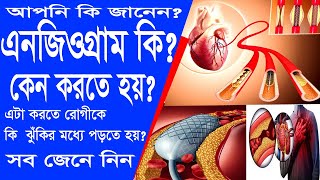 এনজিওগ্রাম কি?কেনো করতে হয়?করতে রোগীকে ঝুঁকি কতটা?what is Angiogram?how risky it is to do Angiogram