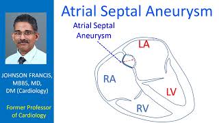 Atrial Septal Aneurysm