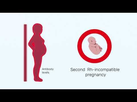 What happens if mom is Rh negative and dad is Rh positive?