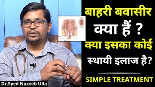 बाहरी बवासीर क्या हैं? क्या इसका कोई स्थायी इलाज है? | Simple Treatment | Dr. Syed Nazeeb Ulla | DQ