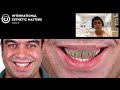 CERAMIC RESTORATIONS - Teeth and Implants - Details that make a difference