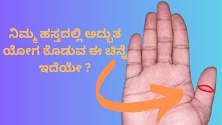 ಈ ಚಿಹ್ನೆ ಕೈಯಲ್ಲಿ ಇದೆಯೇ  ಅದ್ಭುತ ಯೋಗ !!! Oval Symbol on Thumb Finger