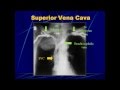 Basics of Chest Imaging (2008)