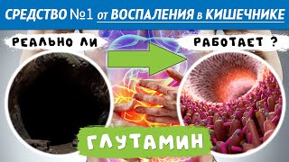 Поможет ли ГЛУТАМИН вылечить воспаление в кишечнике? Исследования на пациентах. Болезнь Крона. НЯК