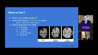 Cardiac CT and Plaque Assessment: More than a diagnosis.