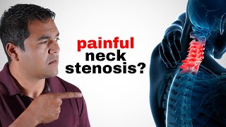 10 Things You Should AVOID if You Have Neck Cervical Stenosis