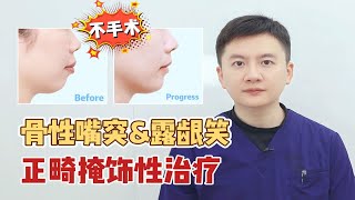 骨性嘴突+露龈笑，牙齿矫正可以到什么效果？