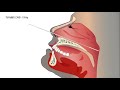 gmate® covid 19 ag rapid test kit nasopharyngeal u0026 oropharyngeal sample