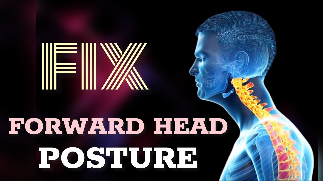 Fix Forward Head Posture Youtube