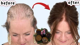 Put these ingredients in shampoo!  Accelerates hair growth, treats baldness