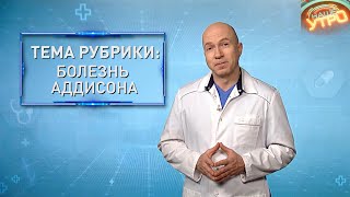 БОЛЕЗНЬ АДДИСОНА – чем опасна дисфункция коры надпочечников | Формула здоровья