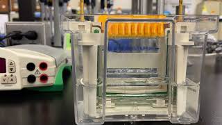 Loading an SDS-PAGE gel (and protein sample preps)