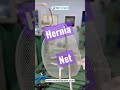 hernia net kaisa hota hai hernia operation kaise hota hai 3d inguinal hernia mesh