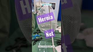 Hernia Net Kaisa hota hai ? Hernia Operation kaise hota hai ? 3D Inguinal Hernia Mesh
