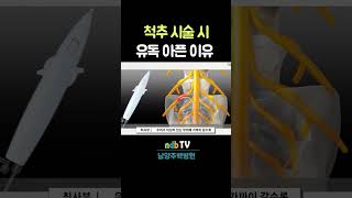 척추시술 하면 왜 아플까요? (18년차 정형외과 의사) #신경성형술