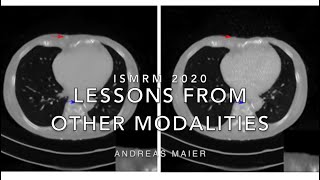 ISMRM 2020, Joint MICCAI-ISMRM Session - Lessons from other modalities