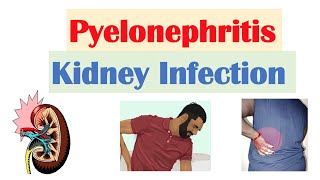 Pyelonephritis (Kidney Infection) | Causes, Pathophysiology, Signs & Symptoms, Diagnosis, Treatment