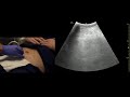 transabdominal pelvis ultrasound scanning techniques