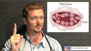 PCOS: Could it be Your DIET? (Fertility Update 2024)
